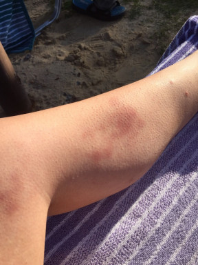 AAFAEDCE-5F0B-4FE9-8D89-000924898C3C_1_105_c